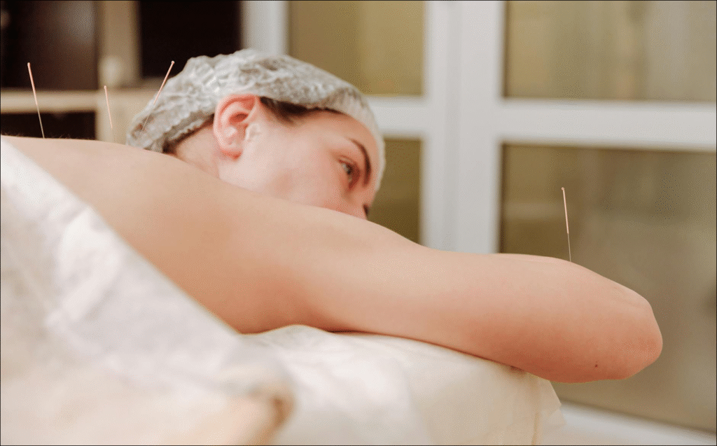 Acupuncture for Modern Living